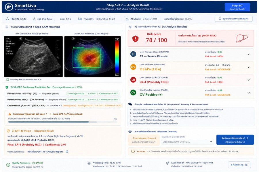 SmartLiva Analysis Result